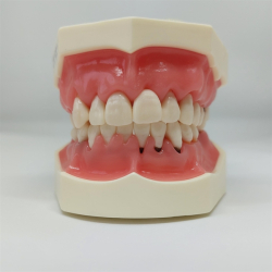 Model til trning af parodontale behandlingsteknikker 